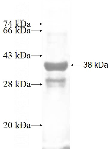Recombinant Human TCEB1 SDS-PAGE