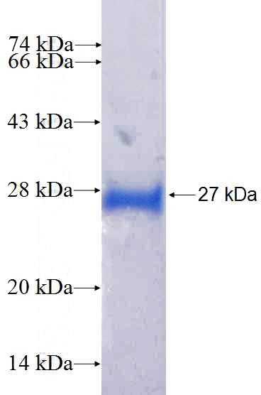 Recombinant Human HEBP1 SDS-PAGE