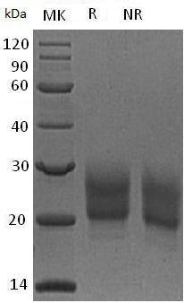Human NCR3/1C7/LY117 (His tag) recombinant protein