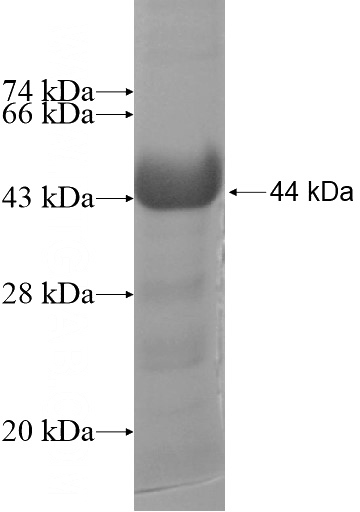 Recombinant Human SSH1 SDS-PAGE