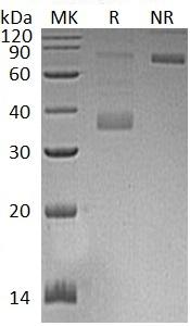 Human MFAP4 (His tag) recombinant protein