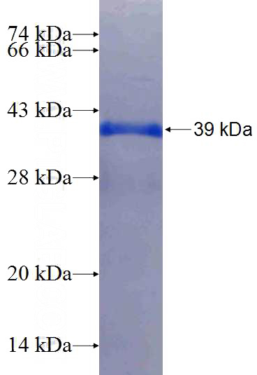 Recombinant Human SLC39A14 SDS-PAGE