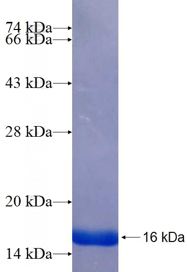 Recombinant Human FCRLA SDS-PAGE