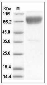 Mouse CD86/B7-2 (His & Fc Tag) recombinant protein