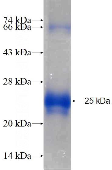 Recombinant Human LYZL1 SDS-PAGE