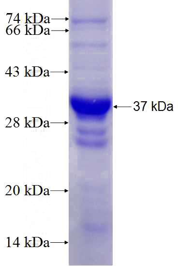 Recombinant Human USP25 SDS-PAGE