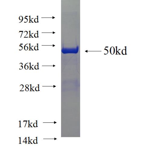 Recombinant human UBE3A SDS-PAGE