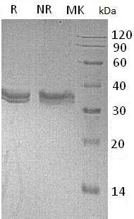 Mouse Ca4/Car4 (His tag) recombinant protein