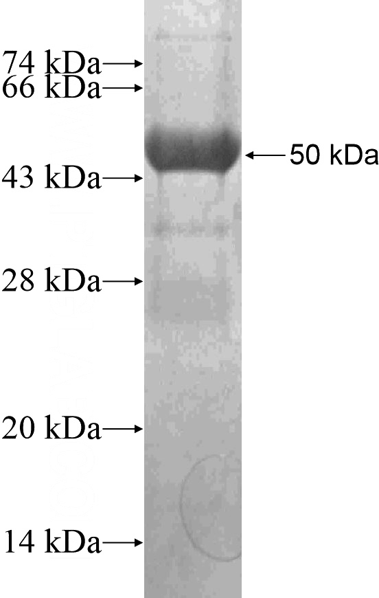 Recombinant Human BICD1 SDS-PAGE