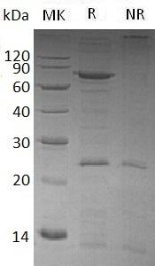 Human VCP (His tag) recombinant protein