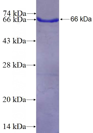 Recombinant Human Integrin beta-8 SDS-PAGE
