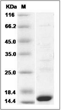 Human PAX8 Protein (His Tag) SDS-PAGE