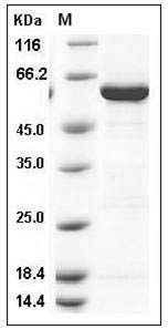 Human GALK1 / Galactokinase / Galactose kinase Protein (His & GST Tag) SDS-PAGE