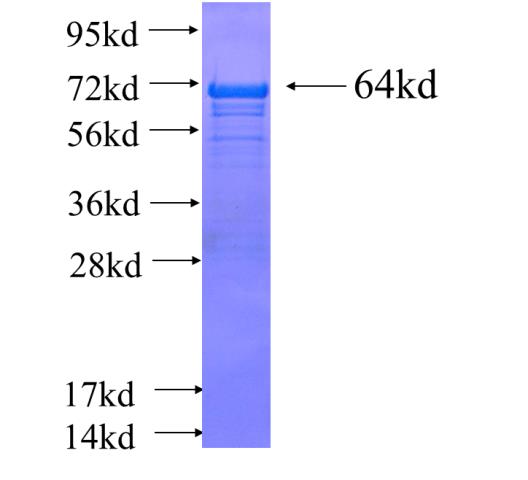 Recombinant human CALCOCO1 SDS-PAGE