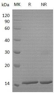 Human HBA1;/HBA2 (His tag) recombinant protein
