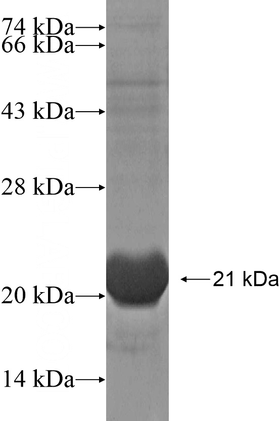 Recombinant Human SLC38A9 SDS-PAGE