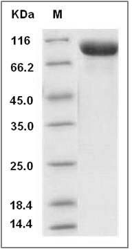Mouse Tie2 / TEK Protein (His Tag) SDS-PAGE