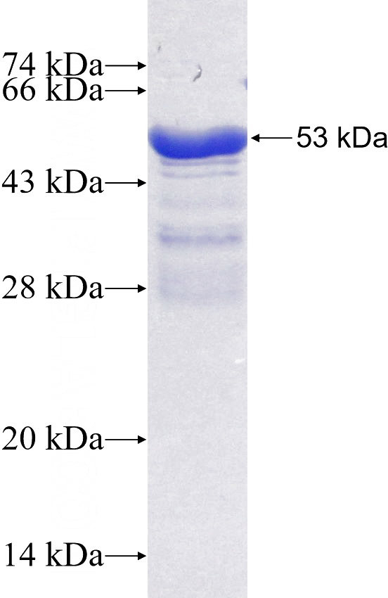 Recombinant Human Tubulin-beta SDS-PAGE
