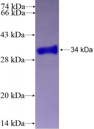 Recombinant Human FGF5 SDS-PAGE