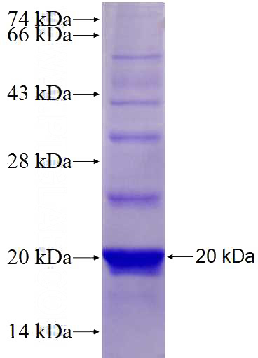 Recombinant Human KL SDS-PAGE