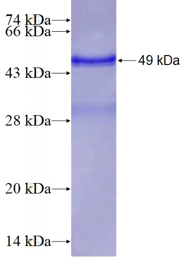 Recombinant Human RAB25 SDS-PAGE