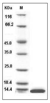 Human SH2D1A Protein (His Tag) SDS-PAGE