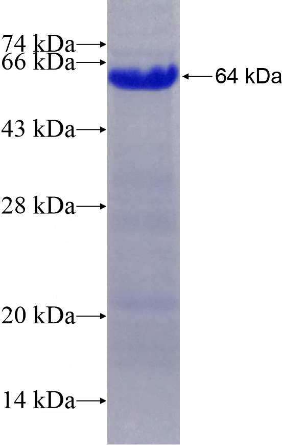 Recombinant Human HRD1 SDS-PAGE