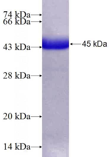 Recombinant Human KRT5 SDS-PAGE