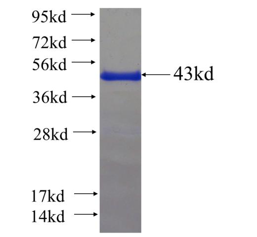 Recombinant human CCDC41 SDS-PAGE