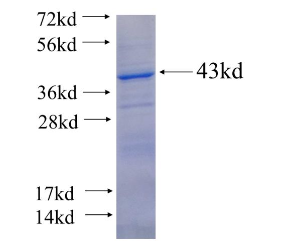 Recombinant human HGD(Full length) SDS-PAGE