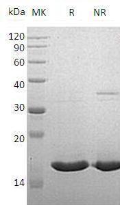 Human VAPB/UNQ484/PRO983 (His tag) recombinant protein