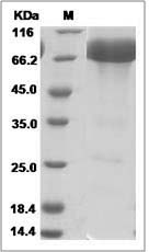 Mouse PD-L1 / B7-H1 / CD274 Protein (Fc Tag)