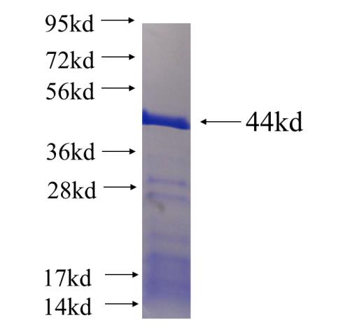 Recombinant human TTC26 SDS-PAGE
