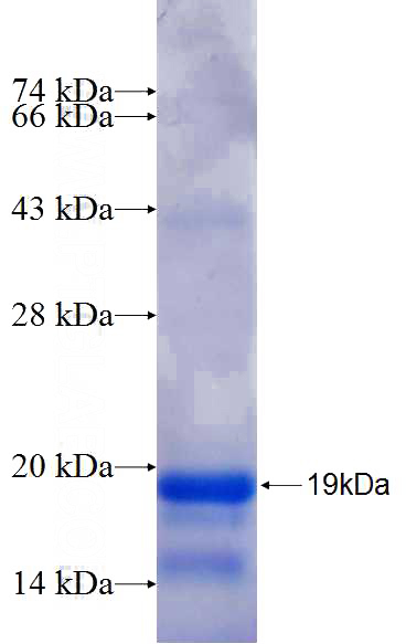 Recombinant Human LARP6 SDS-PAGE