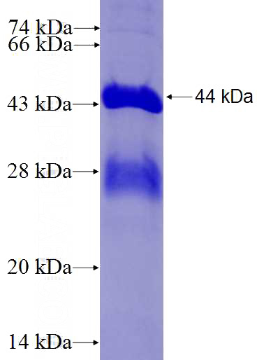 Recombinant Human MGC12966 SDS-PAGE