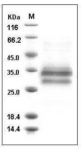 Mouse IL25 Protein (His Tag) SDS-PAGE
