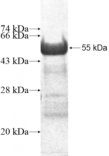 Recombinant Human ARMC10 SDS-PAGE