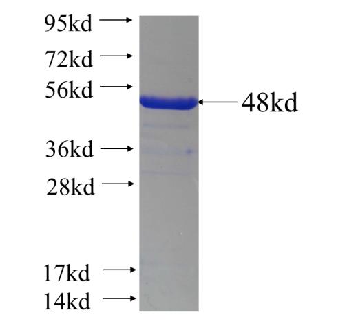 Recombinant human BTNL2 SDS-PAGE