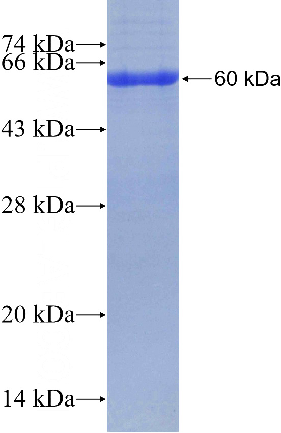 Recombinant Human CPA6 SDS-PAGE