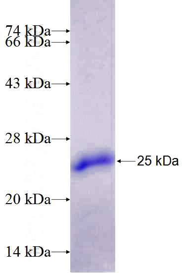 Recombinant Human CLEC5A SDS-PAGE
