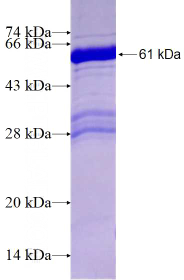 Recombinant Human RAI2 SDS-PAGE