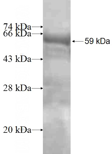 Recombinant Human NMRAL1 SDS-PAGE