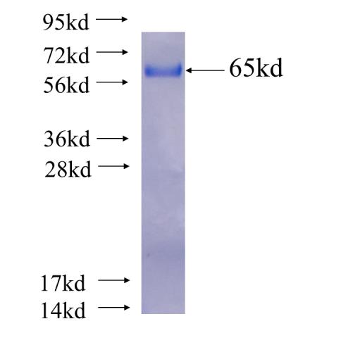 Recombinant human VEZT SDS-PAGE