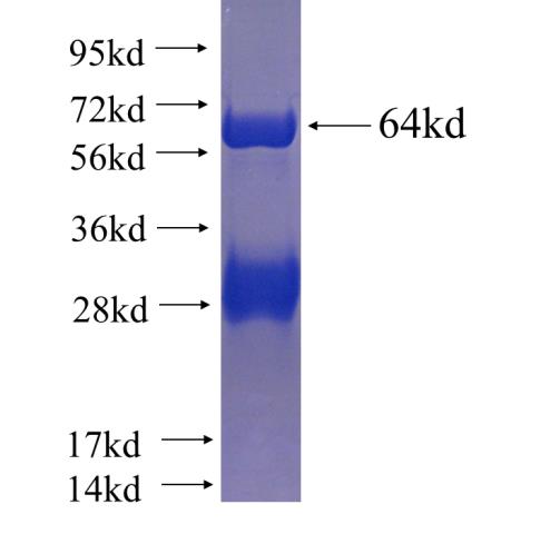 Recombinant human EPAS1 SDS-PAGE
