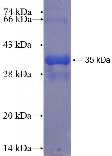 Recombinant Human RGS11 SDS-PAGE
