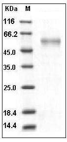 Human MMP7 Protein (Fc Tag) SDS-PAGE