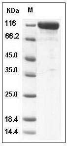 Human CD10 / Neprilysin / MME Protein (Fc Tag) SDS-PAGE