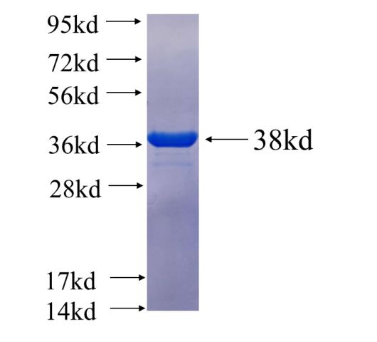 Recombinant human ZNF497 SDS-PAGE