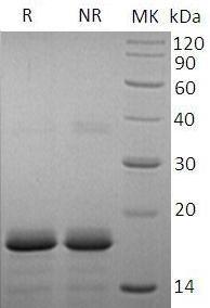 Human PPP3R1/CNA2/CNB (His tag) recombinant protein
