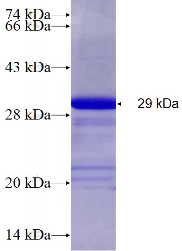 Recombinant Human PHKA1 SDS-PAGE
